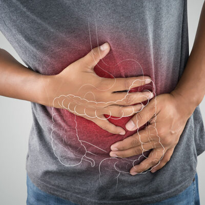 7 Common Signs of Colon Cancer