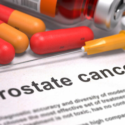 5 Common Signs of Prostate Cancer