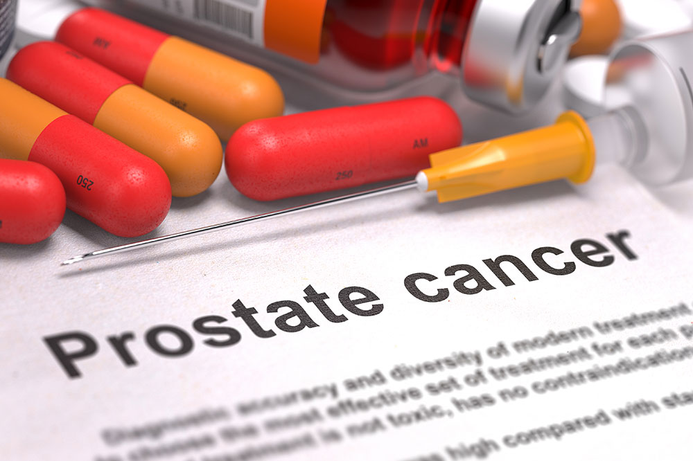 5 Common Signs of Prostate Cancer